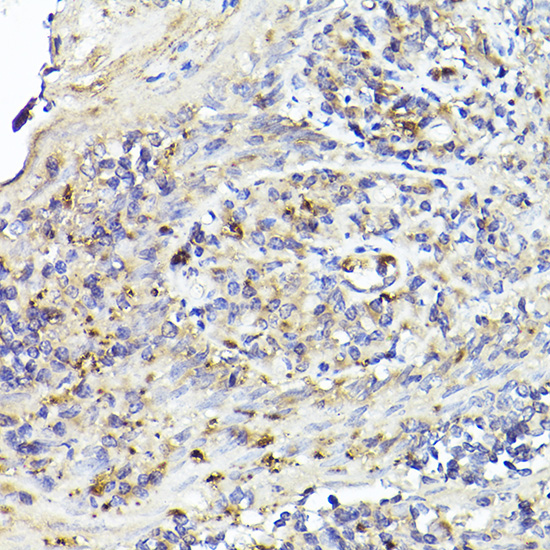 Anti-IL6R Rabbit pAb