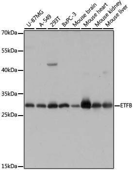 Anti-ETFB Rabbit pAb