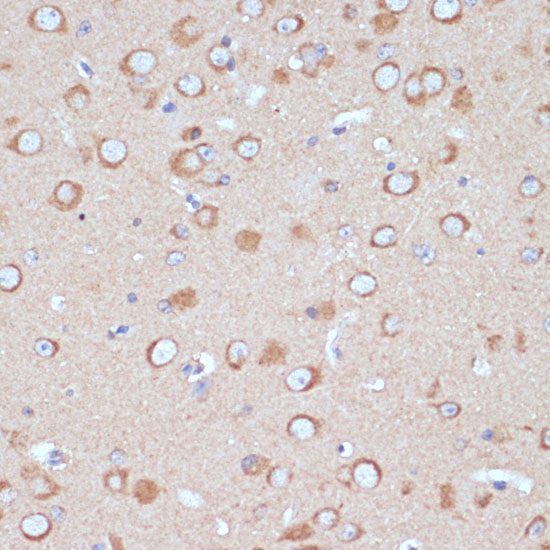 Anti-COPG2 Rabbit pAb