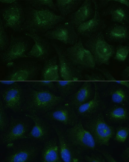 Anti-COPG2 Rabbit pAb
