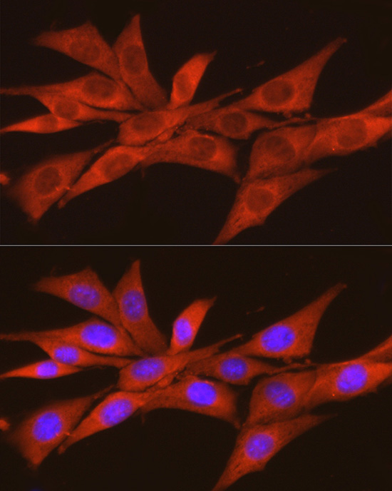 Anti-CSNK2A2 Rabbit pAb