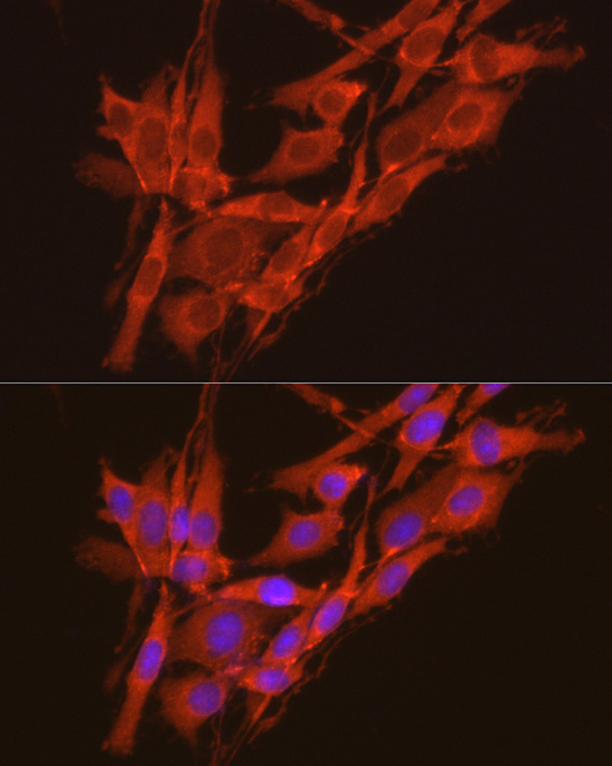 Anti-CSNK2A2 Rabbit pAb