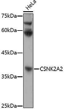 Anti-CSNK2A2 Rabbit pAb