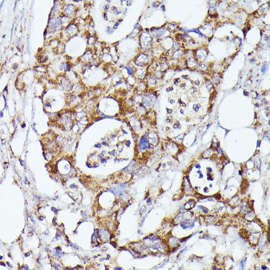 Anti-CDK5RAP1 Rabbit pAb