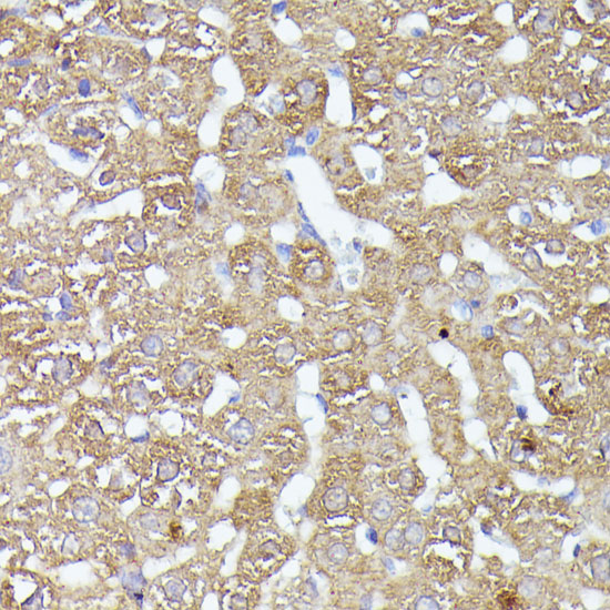 Anti-CDK5RAP1 Rabbit pAb