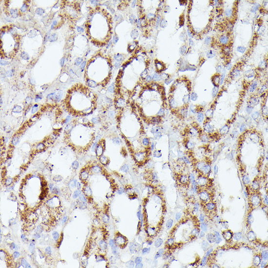 Anti-CDK5RAP1 Rabbit pAb