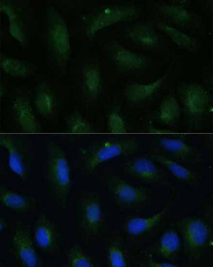 Anti-COPG2 Rabbit pAb