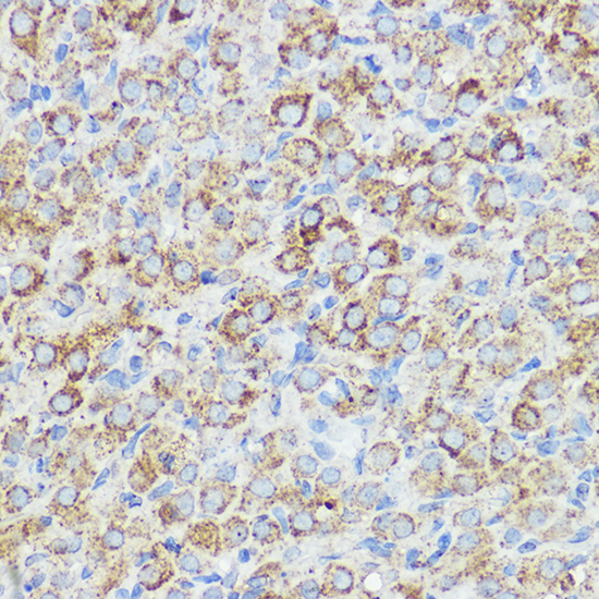 Anti-ABI1 Rabbit pAb