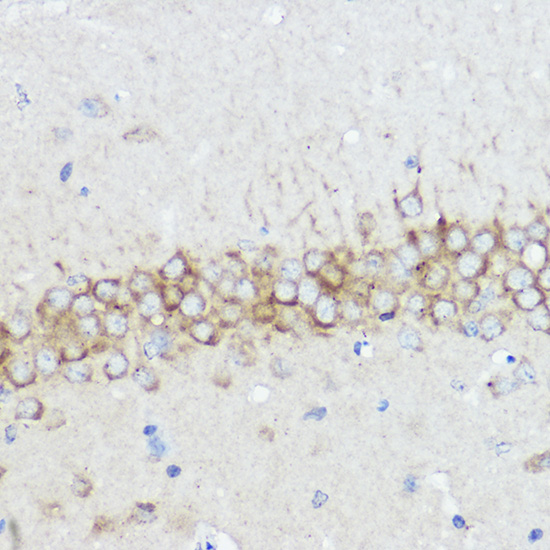 Anti-ABI1 Rabbit pAb
