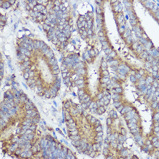 Anti-ABI1 Rabbit pAb