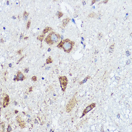 Anti-ABI1 Rabbit pAb