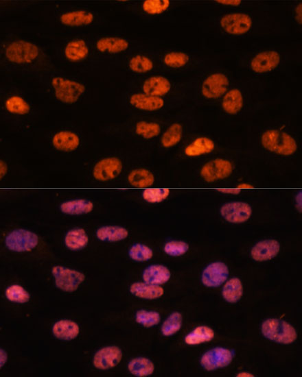 Anti-MYEF2 Rabbit pAb