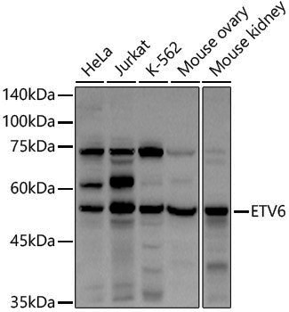 Anti-ETV6 Rabbit pAb