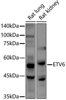 Anti-ETV6 Rabbit pAb