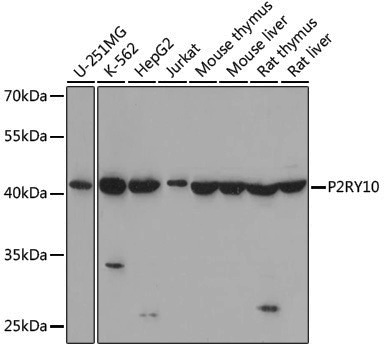 Anti-P2RY10 Rabbit pAb