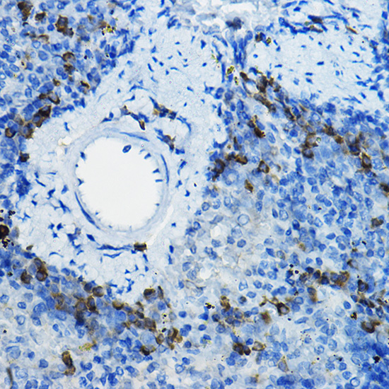 Anti-Beta-TRCP Rabbit pAb