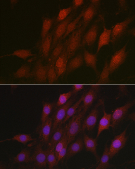 Anti-Beta-TRCP Rabbit pAb
