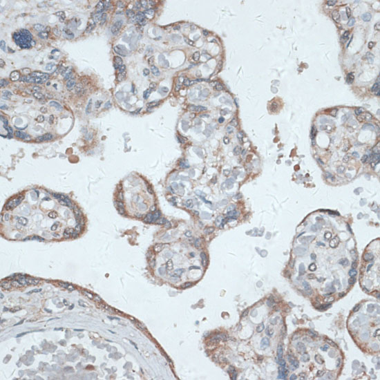 Anti-PMEPA1 Rabbit pAb