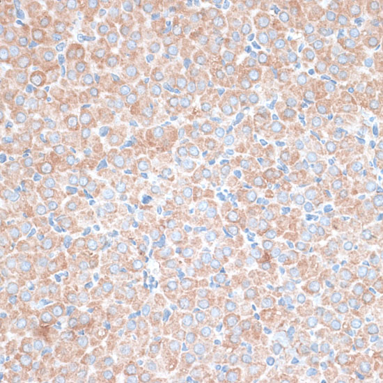 Anti-PMEPA1 Rabbit pAb