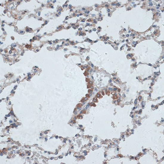 Anti-PMEPA1 Rabbit pAb