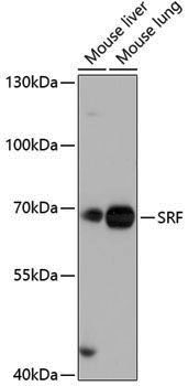 Anti-SRF Rabbit pAb