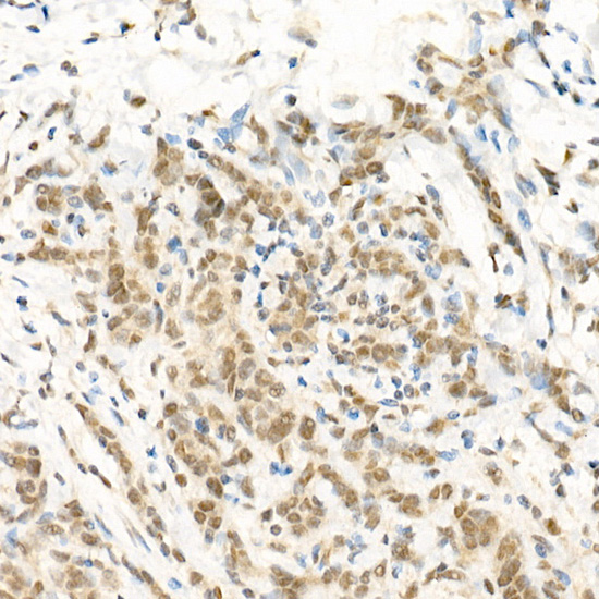 Anti-RGS2 Rabbit pAb