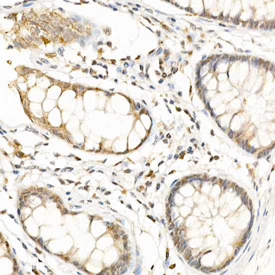 Anti-RGS2 Rabbit pAb