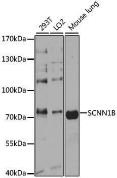 Anti-SCNN1B Rabbit pAb