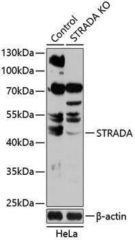 [KO Validated] Anti-STRADA Rabbit pAb