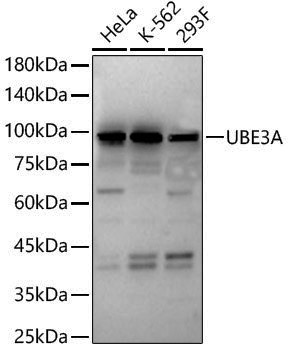 Anti-UBE3A Rabbit pAb