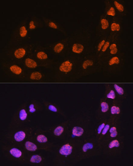 Anti-MAML2 Rabbit pAb