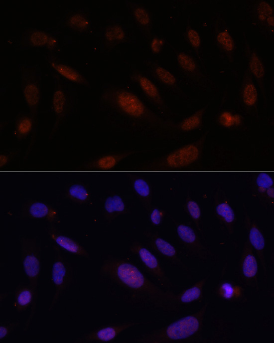 Anti-Bcl9 Rabbit pAb