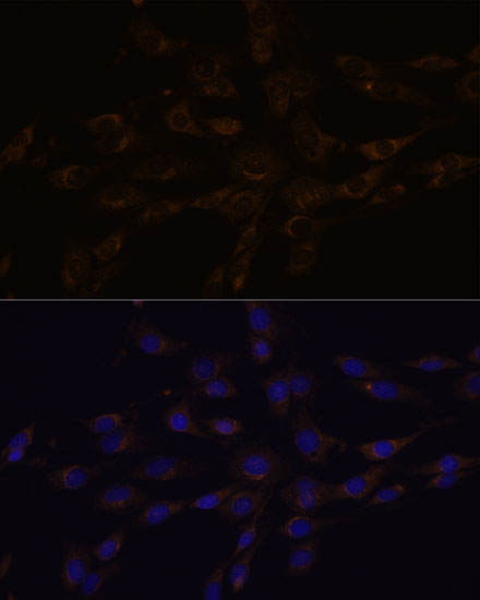 Anti-RGS4 Rabbit pAb