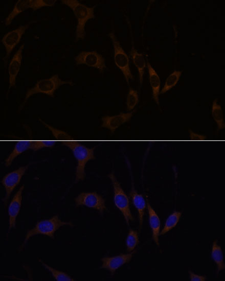 Anti-RGS4 Rabbit pAb