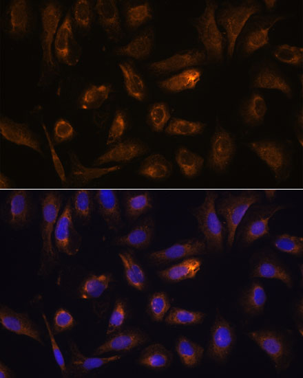 Anti-RGS4 Rabbit pAb