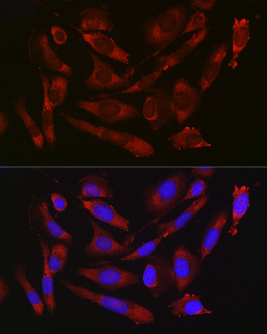 Anti-CD47 Rabbit pAb