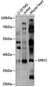 Anti-SPRY2 Rabbit pAb