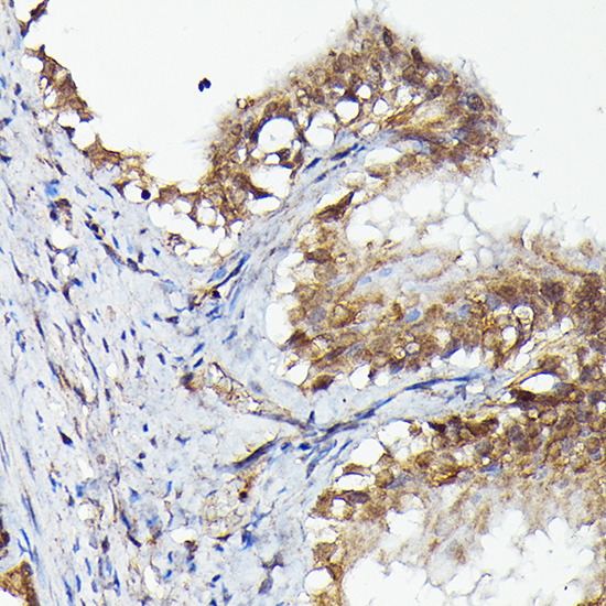 Anti-MKNK1 Rabbit pAb