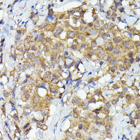 Anti-MKNK1 Rabbit pAb
