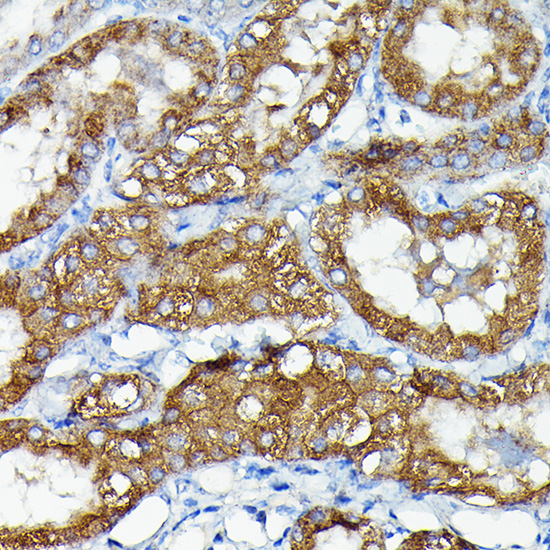 Anti-MKNK1 Rabbit pAb