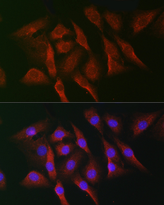 Anti-MKNK1 Rabbit pAb