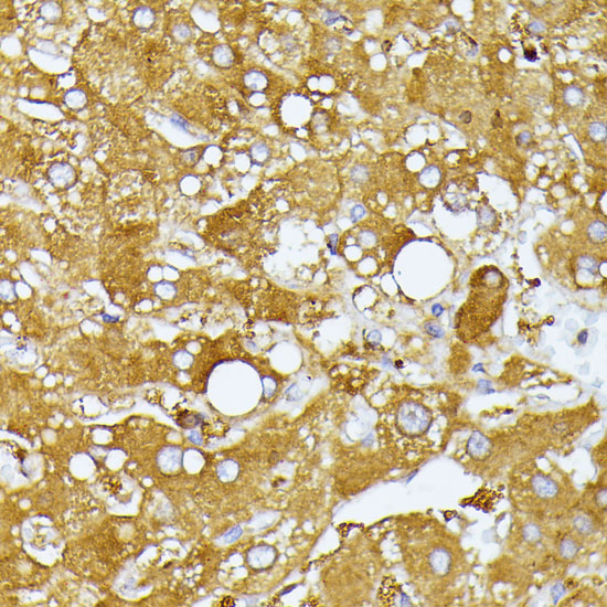 Anti-ITPR2 Rabbit pAb