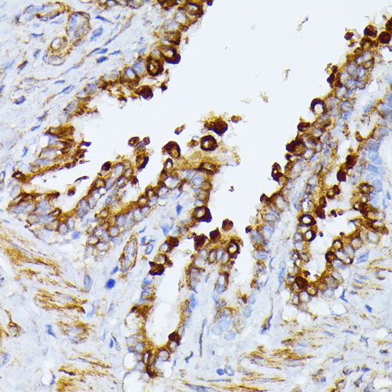 Anti-ITPR2 Rabbit pAb