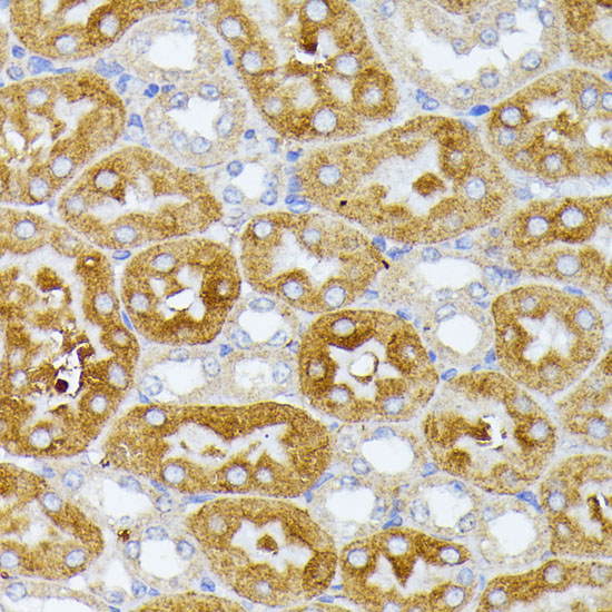 Anti-ITPR2 Rabbit pAb