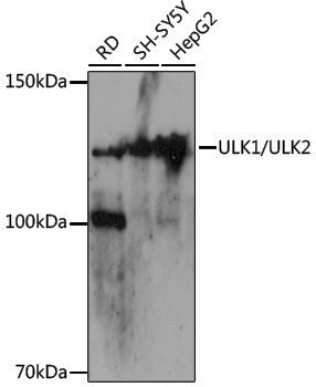 Anti-ULK1/ULK2 Rabbit pAb