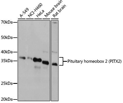 Anti-PITX2 Rabbit pAb