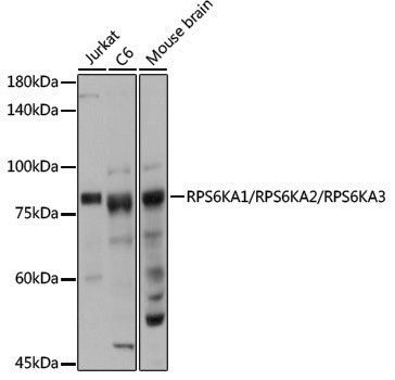 Anti-RPS6KA1/RPS6KA2/RPS6KA3 Rabbit pAb