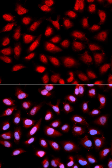 Anti-Ser/Thr-PP2A activator Rabbit pAb
