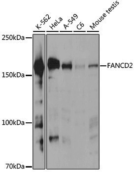 Anti-FANCD2 Rabbit pAb