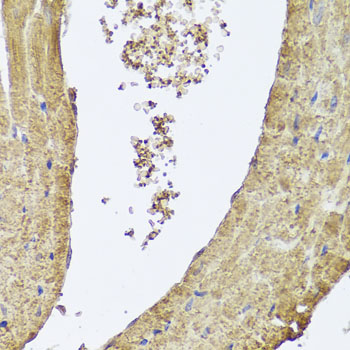 Anti-PIK3C2A Rabbit pAb